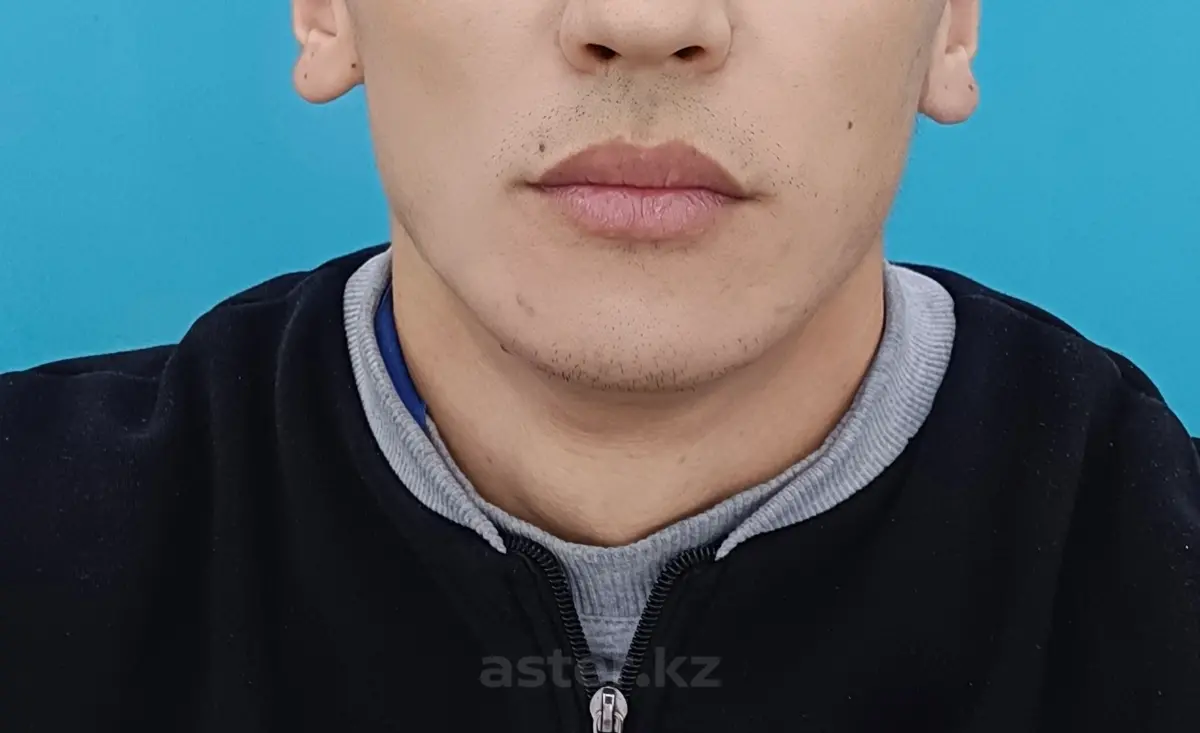 Ақниет